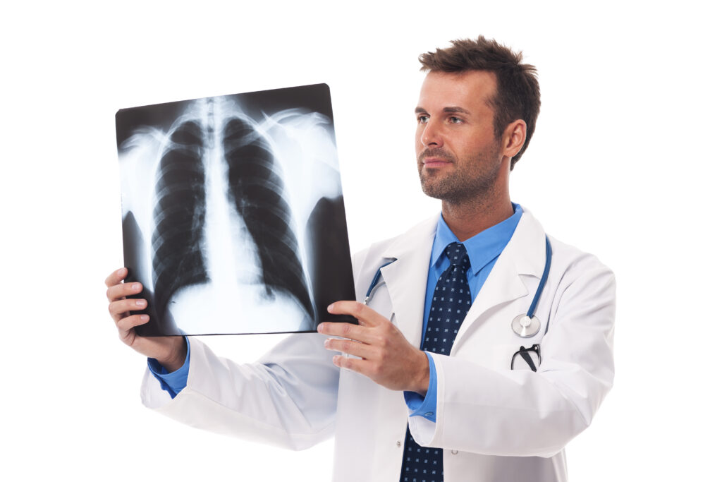Representação de Fibrose Pulmonar Idiopática